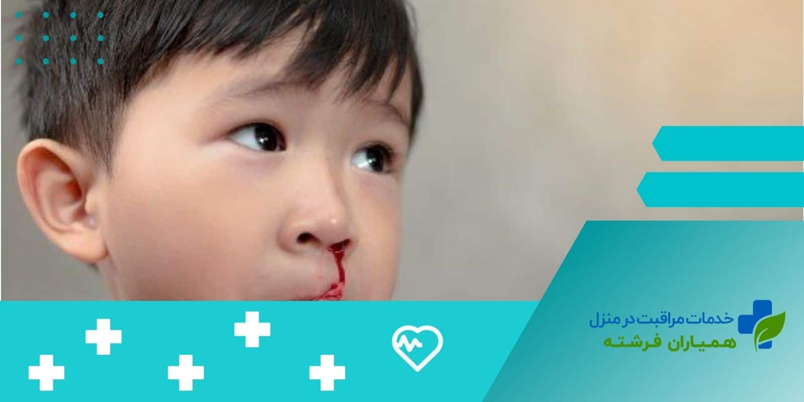  آیا خون‌دماغ شدن در کودکان می ‌تواند نشانه‌ای از یک مشکل جدی باشد؟