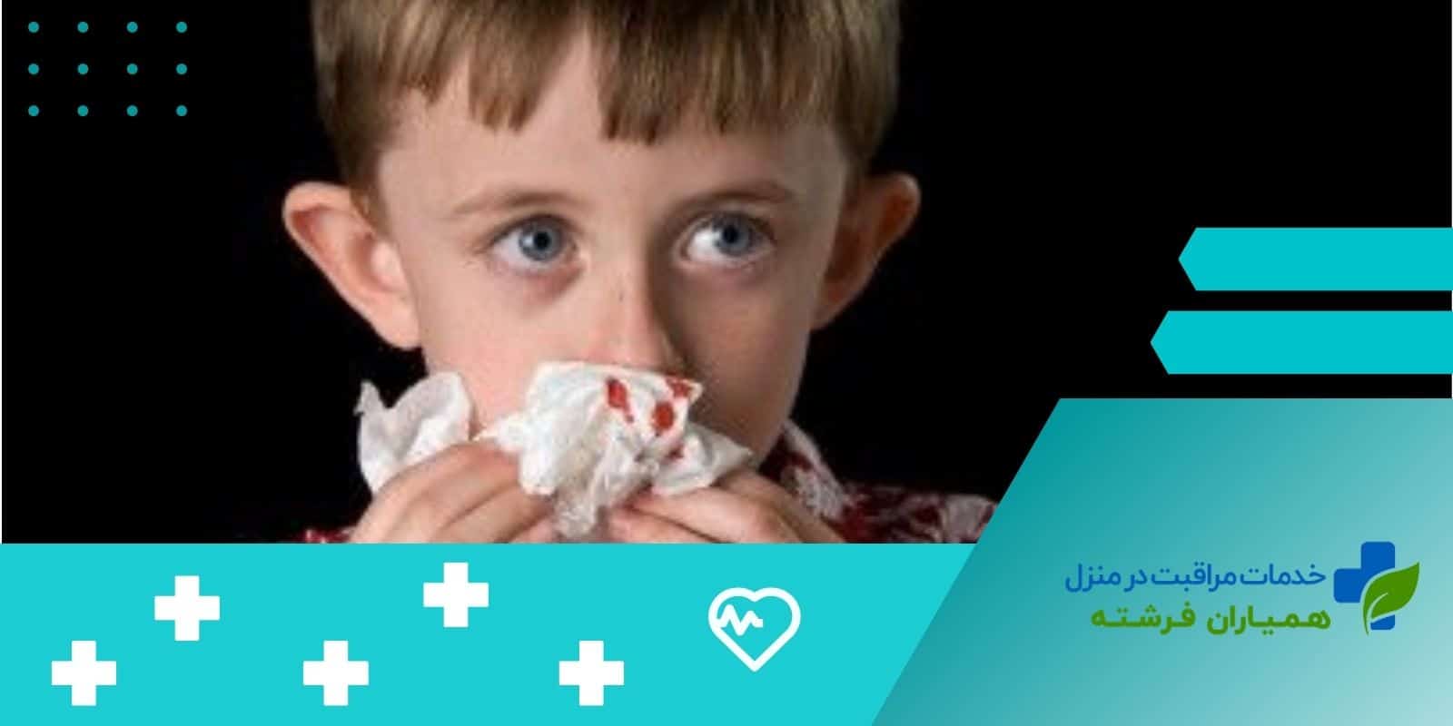  روش‌های خانگی برای درمان خون‌دماغ شدن