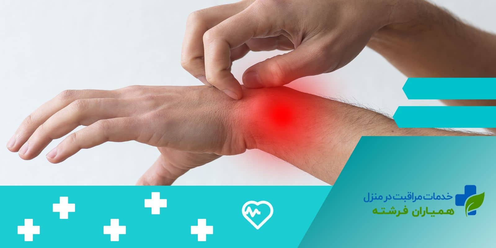  آبله مرغان در کودکان(علائم+پیشگیری+تشخیص و درمان)
