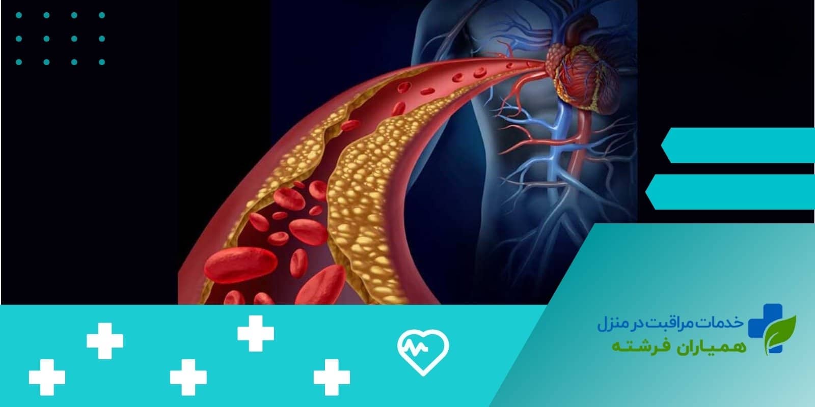  گرفتگی رگ قلب چیست؟