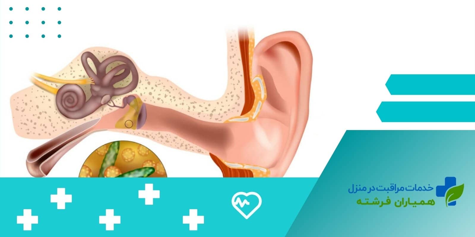 انواع عفونت گوش میانی و علائم آنها