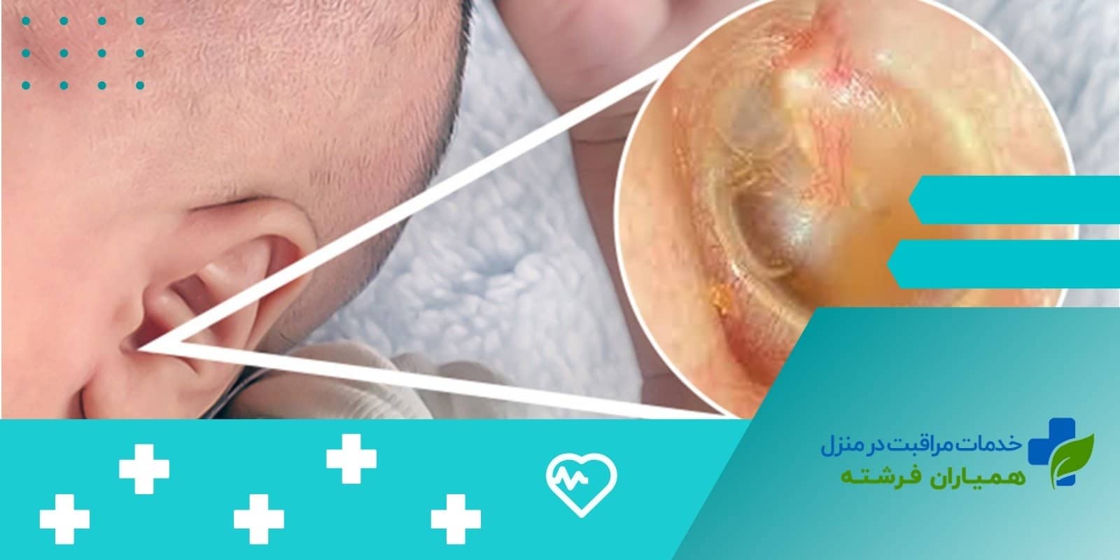  چه تحقیقاتی در مورد عفونت گوش میانی در حال انجام است؟