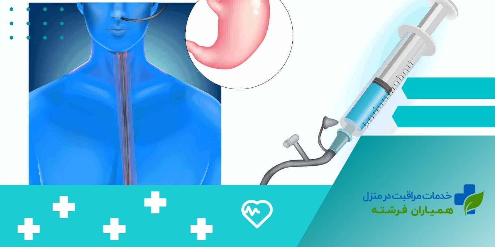 عواقب نصب نادرست لوله تغذیه بینی به معده